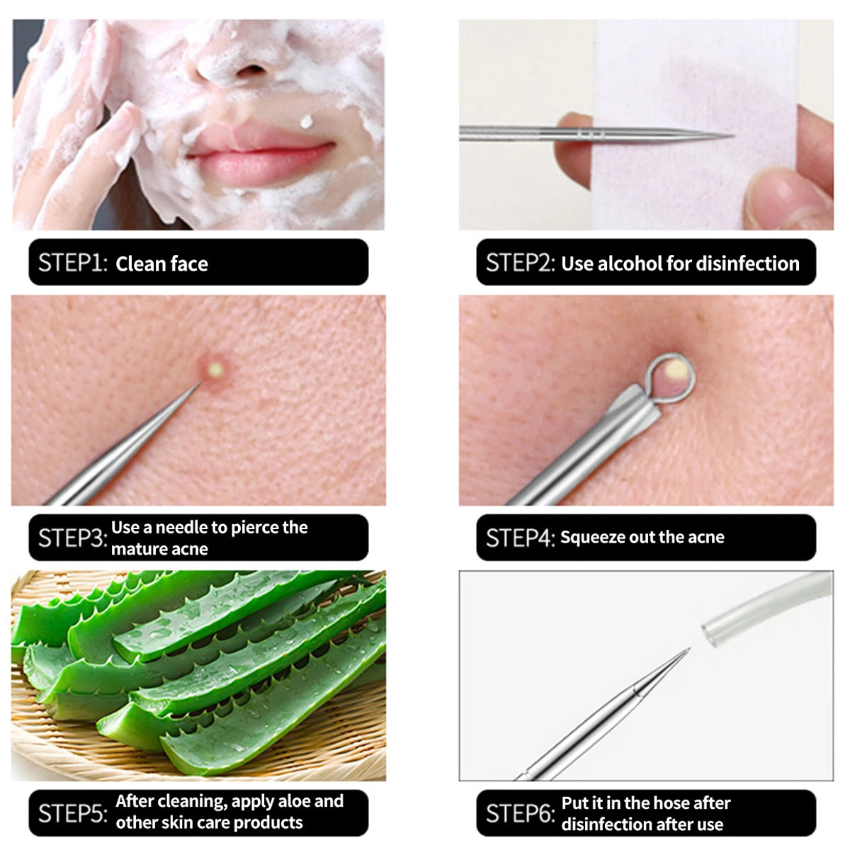 Acne Blackhead/Black Spot Remover