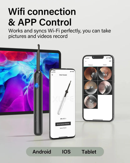 Ear Examiner Smart Visual Stick Otoscope